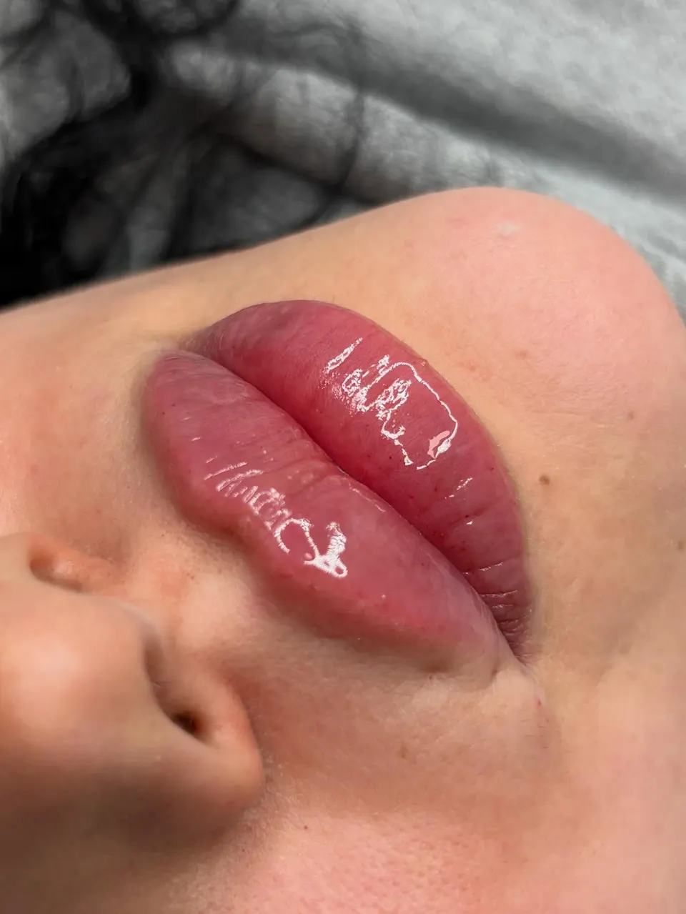 Lip enhancement tailored to natural features