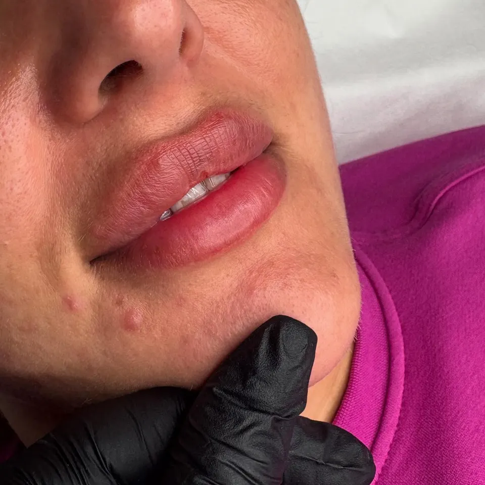 Healed lips, shared without retouching